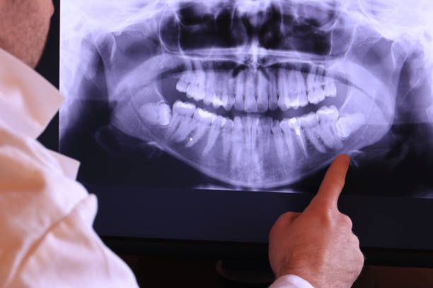 Best Emergency TMJ Treatment in Gordonsville, VA
