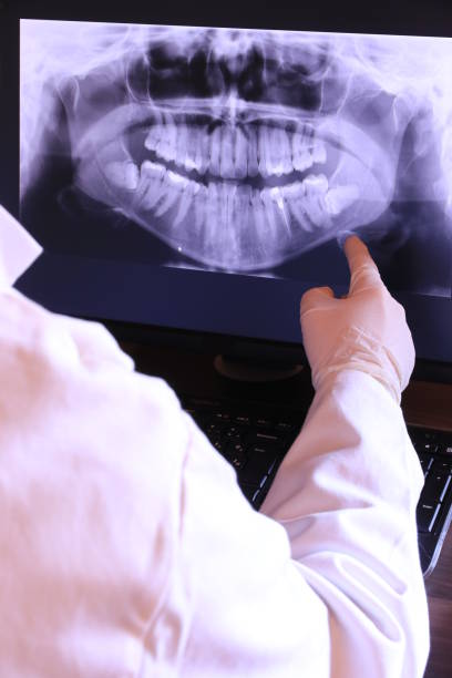 Best Emergency Wisdom Teeth Removal in Gordonsville, VA