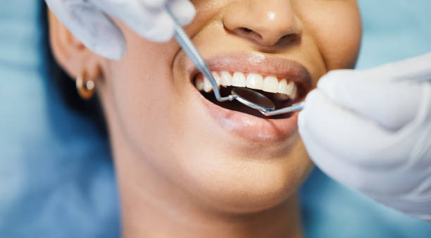 Best Emergency Dental Care for Broken or Chipped Teeth in Gordonsville, VA