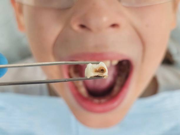 Best Weekend Emergency Dentist in Gordonsville, VA