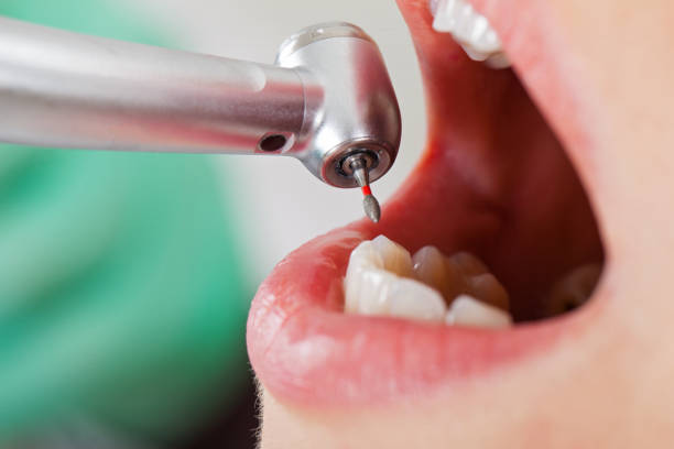 Best After-Hours Dental Trauma Care in Gordonsville, VA